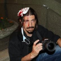 „Fotojournalist der Beta News Agency, Miloš Miškov, verletzt im Juli 2020 bei Anti-Kovid-Demonstrationen in Belgrad BETAPHOTO/Aleksandar Levajković“